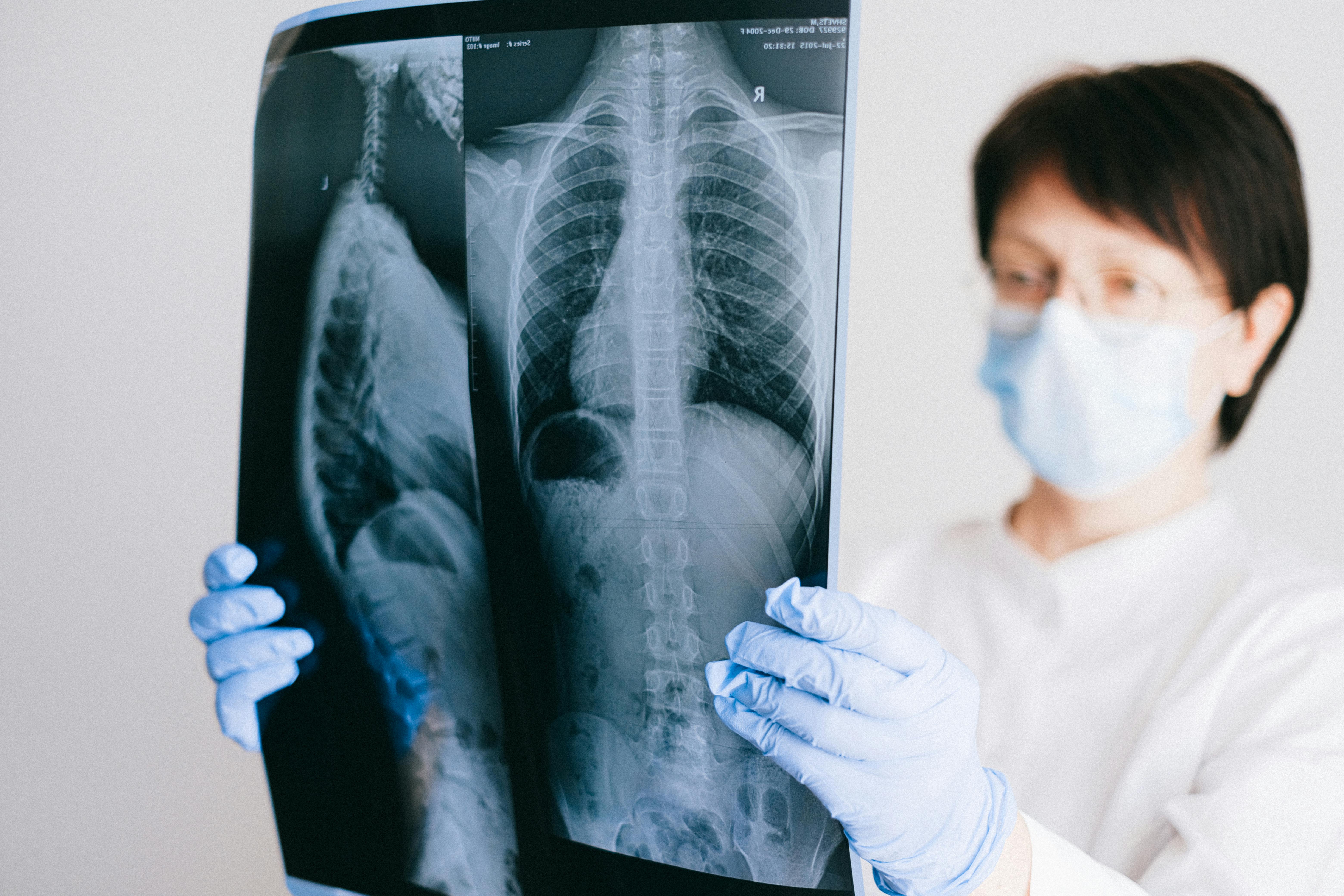 Radiologist Examining X-Ray Results